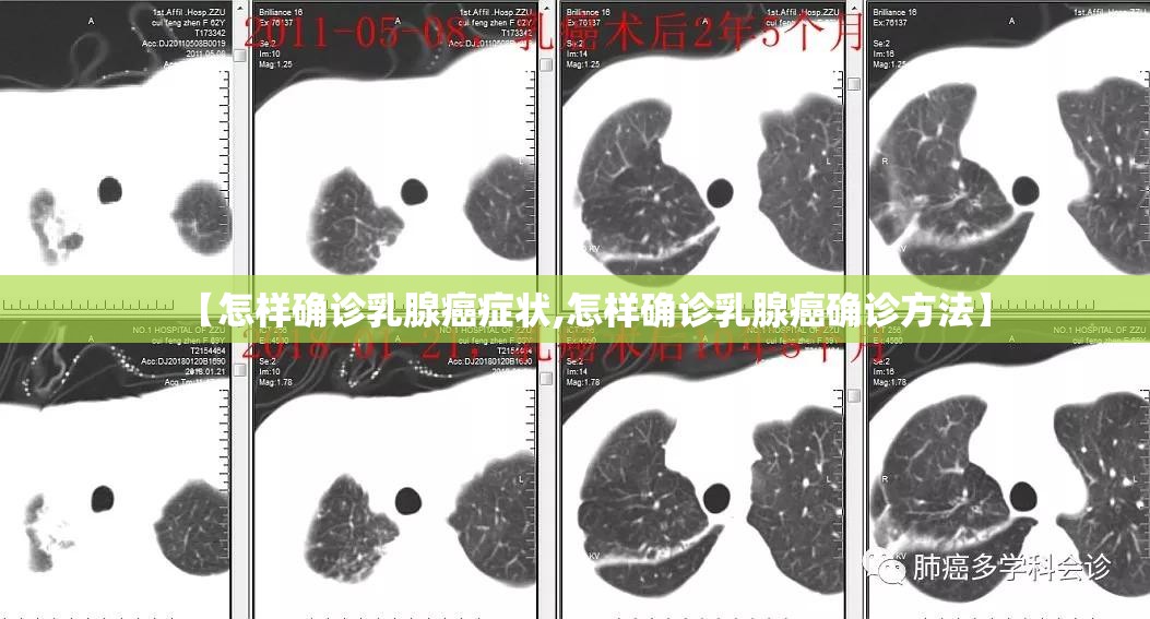 【怎样确诊乳腺癌症状,怎样确诊乳腺癌确诊方法】