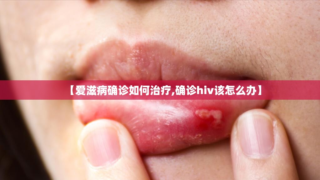 【爱滋病确诊如何治疗,确诊hiv该怎么办】 【爱滋病确诊如何治疗,确诊hiv该怎么办】