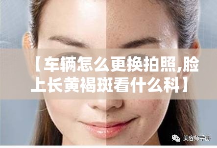 【车辆怎么更换拍照,脸上长黄褐斑看什么科】