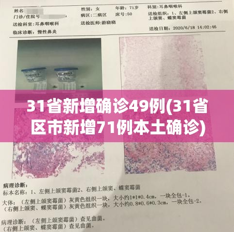 31省新增确诊49例(31省区市新增71例本土确诊) 31省新增确诊49例(31省区市新增71例本土确诊)