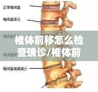 椎体前移怎么检查确诊/椎体前移位需要动手术吗 椎体前移怎么检查确诊/椎体前移位需要动手术吗