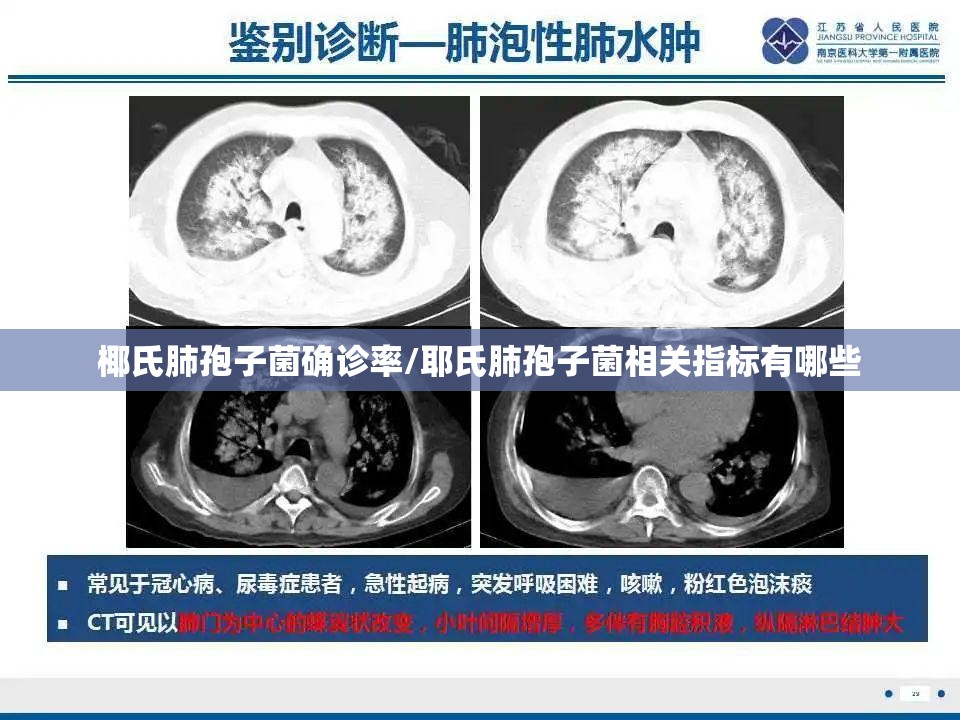 椰氏肺孢子菌确诊率/耶氏肺孢子菌相关指标有哪些