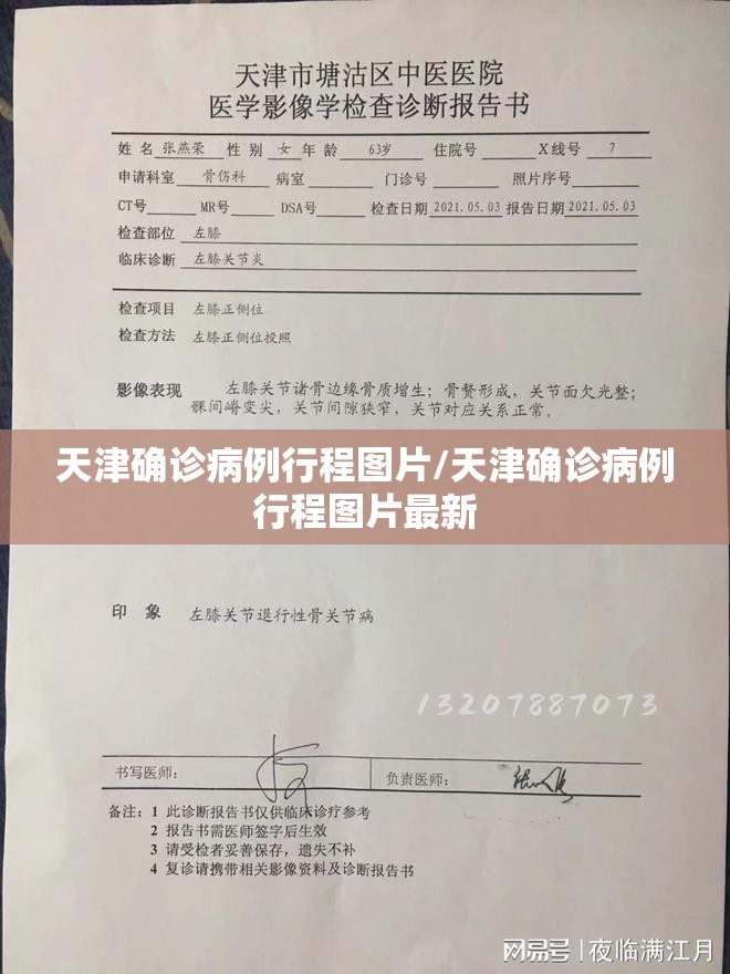 天津确诊病例行程图片/天津确诊病例行程图片最新