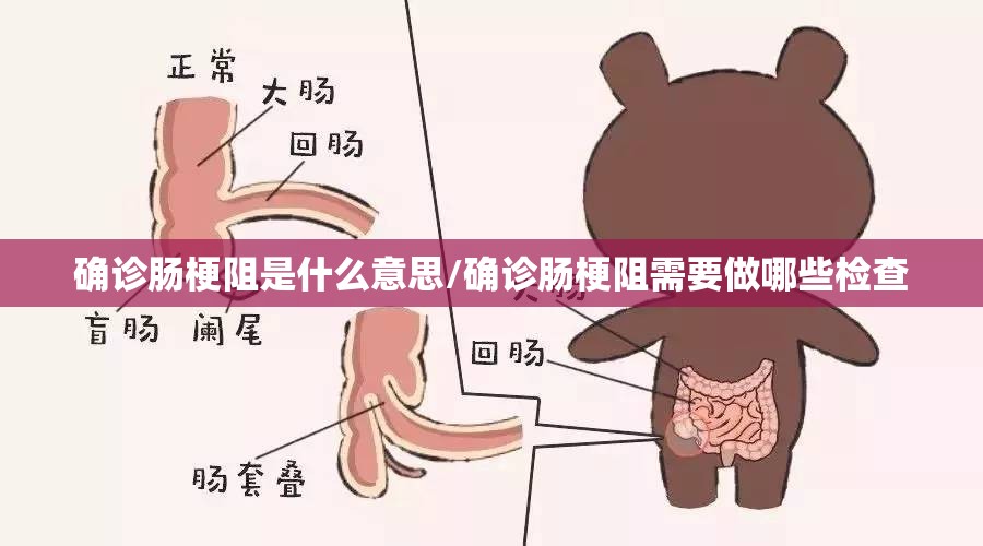 确诊肠梗阻是什么意思/确诊肠梗阻需要做哪些检查