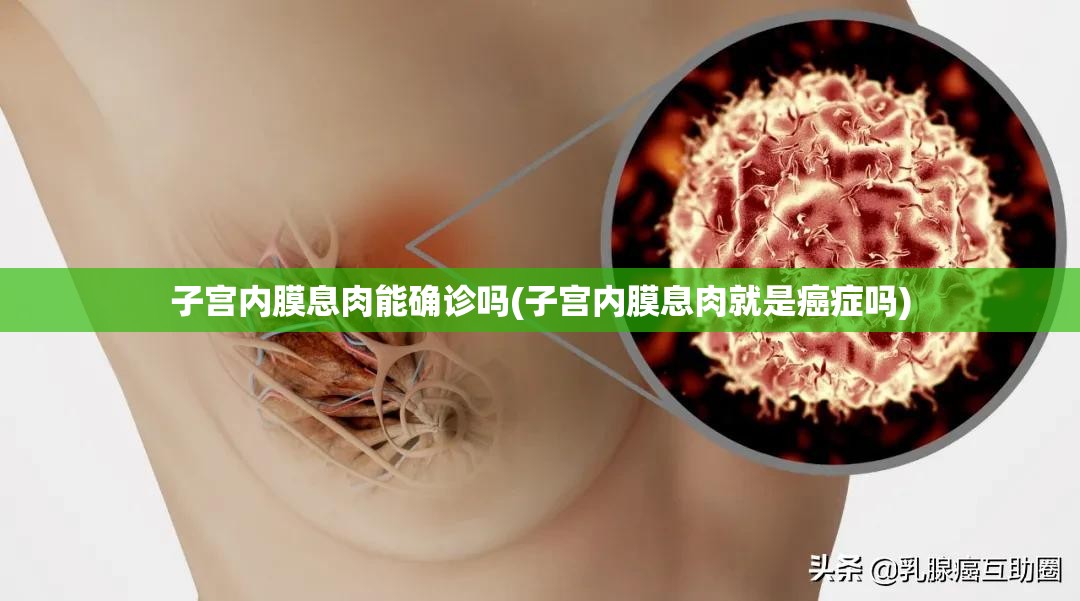 子宫内膜息肉能确诊吗(子宫内膜息肉就是癌症吗) 子宫内膜息肉能确诊吗(子宫内膜息肉就是癌症吗)