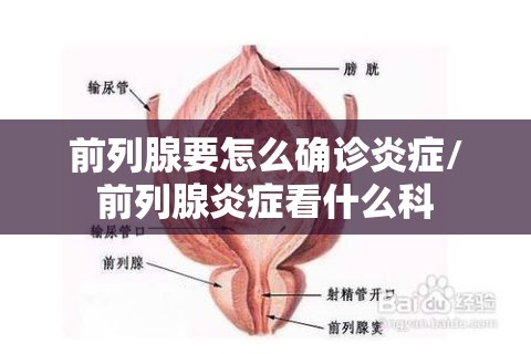 前列腺要怎么确诊炎症/前列腺炎症看什么科