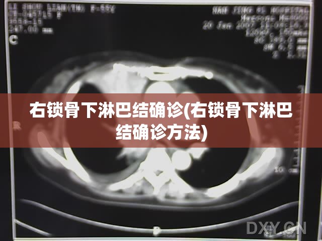 右锁骨下淋巴结确诊(右锁骨下淋巴结确诊方法)