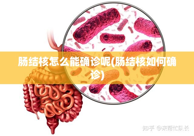 肠结核怎么能确诊呢(肠结核如何确诊)
