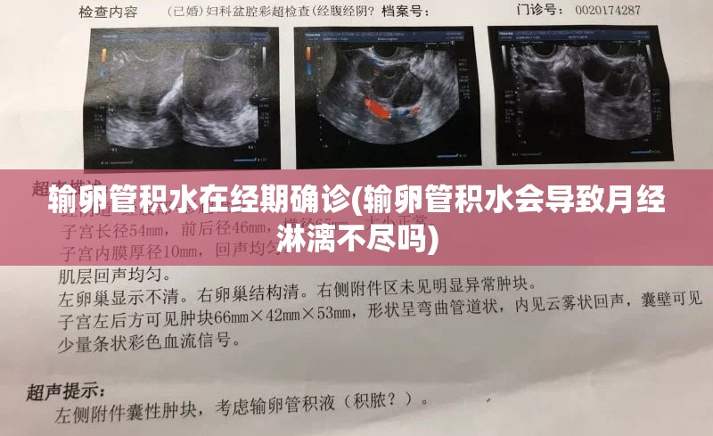 输卵管积水在经期确诊(输卵管积水会导致月经淋漓不尽吗)