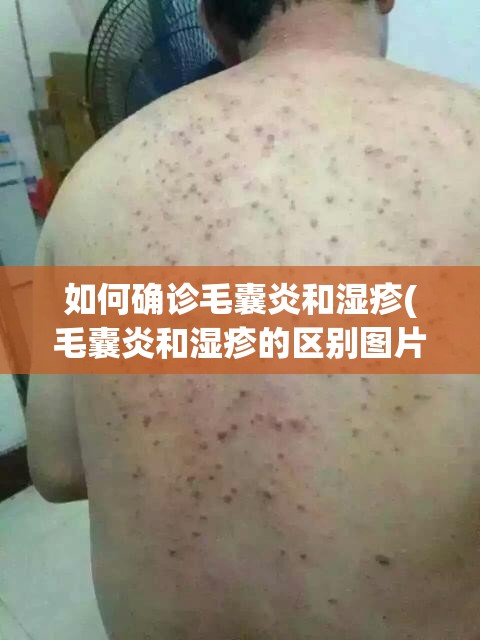 如何确诊毛囊炎和湿疹(毛囊炎和湿疹的区别图片)