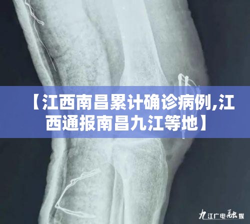【江西南昌累计确诊病例,江西通报南昌九江等地】