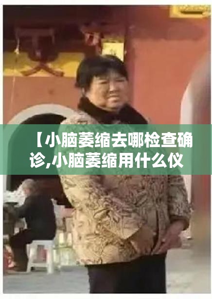 【小脑萎缩去哪检查确诊,小脑萎缩用什么仪器能检查出来】 【小脑萎缩去哪检查确诊,小脑萎缩用什么仪器能检查出来】