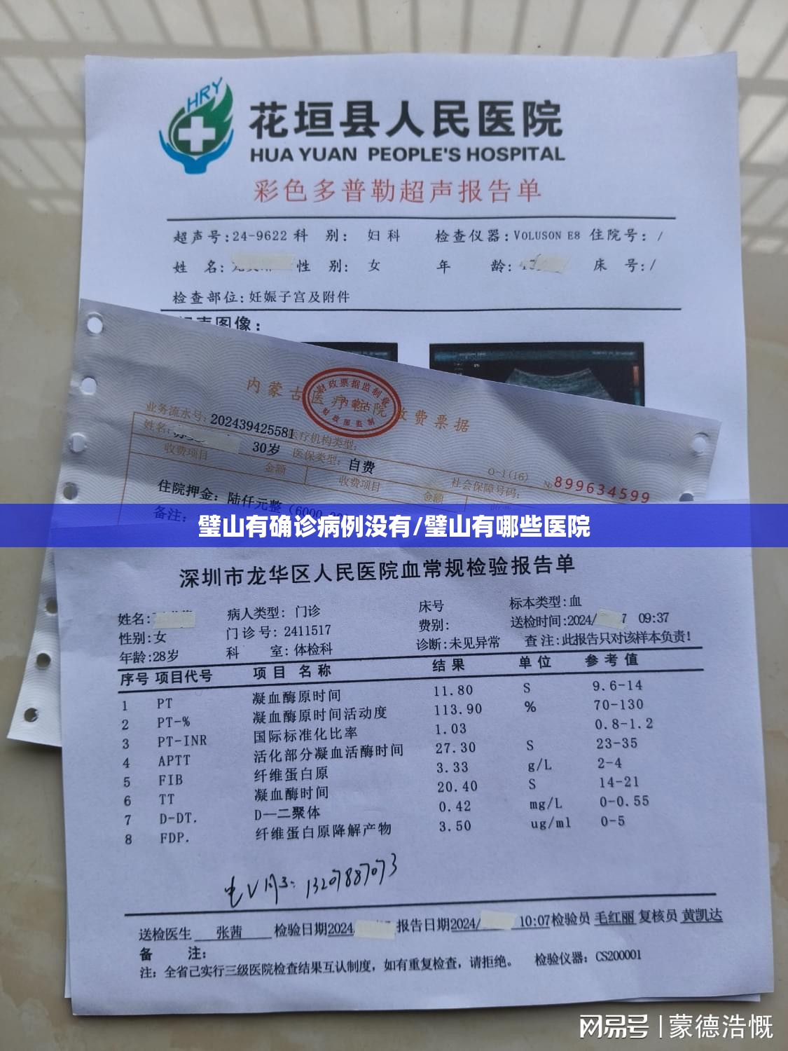璧山有确诊病例没有/璧山有哪些医院