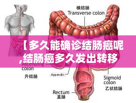 【多久能确诊结肠癌呢,结肠癌多久发出转移】 【多久能确诊结肠癌呢,结肠癌多久发出转移】