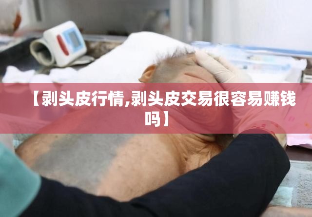 【剥头皮行情,剥头皮交易很容易赚钱吗】 【剥头皮行情,剥头皮交易很容易赚钱吗】