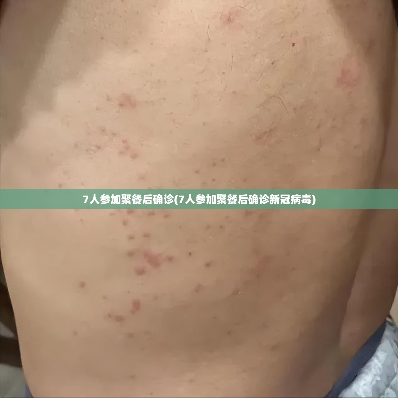 7人参加聚餐后确诊(7人参加聚餐后确诊新冠病毒)