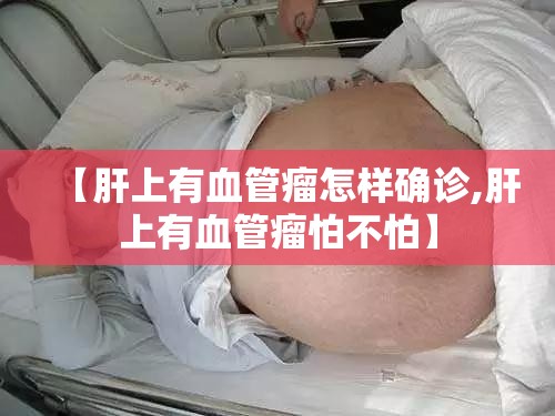 【肝上有血管瘤怎样确诊,肝上有血管瘤怕不怕】